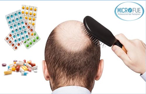 Finasteride normon online